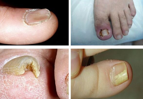 Symptoms of tumors on the legs